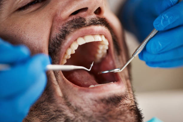 Best Cracked Tooth Emergency Dentist  in Port Sulphur, LA